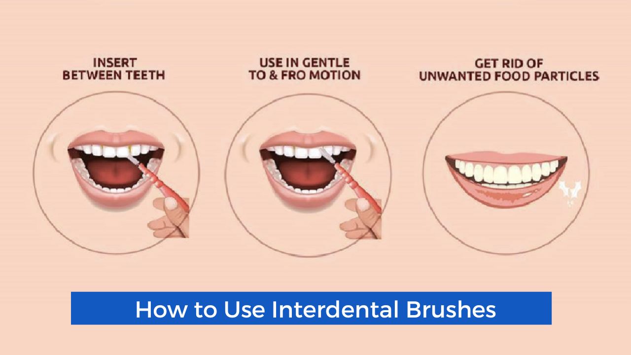Ways to Use of Interdental Brushes Cause Gaps Effectively
