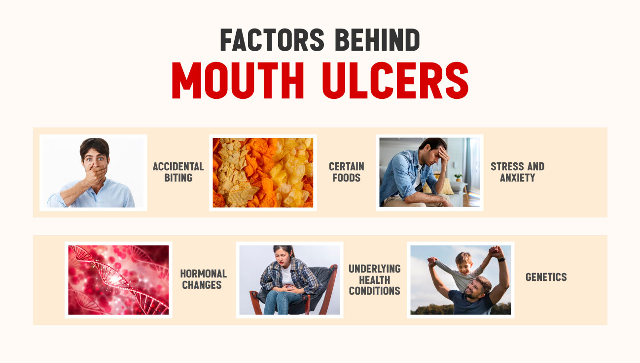 Mouth ulcer causes