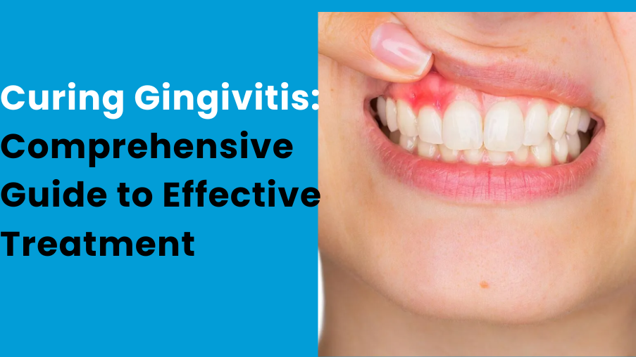 gingivitis-treatment-all-in-one-guide-to-cure-gingivitis
