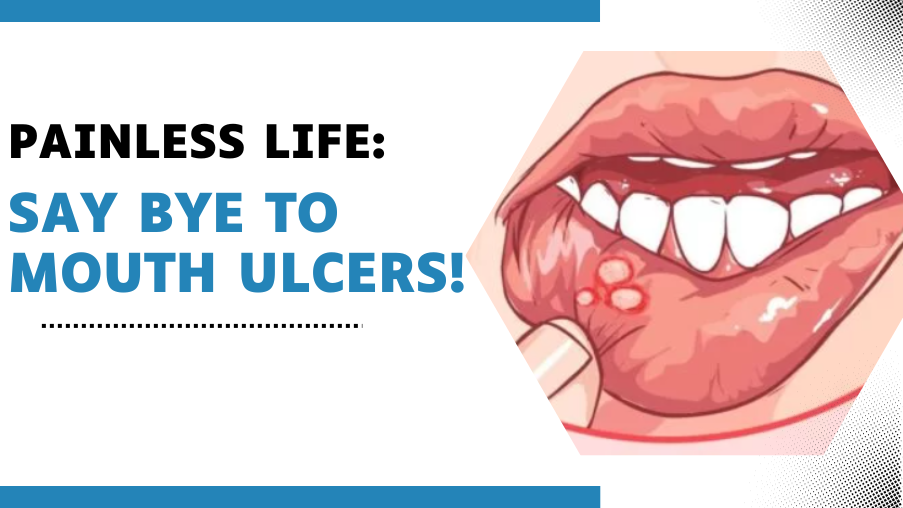 no-more-mouth-ulcers-unveiling-secrets-to-a-pain-free-life